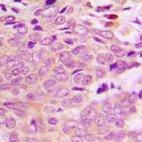 Polyclonal Rabbit anti-Human MRPL40 Antibody (Internal, IHC, WB)