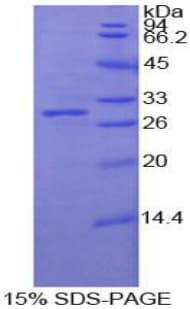 Human PCDHB2 / Protocadherin Beta 2 Protein (Recombinant His-T7)