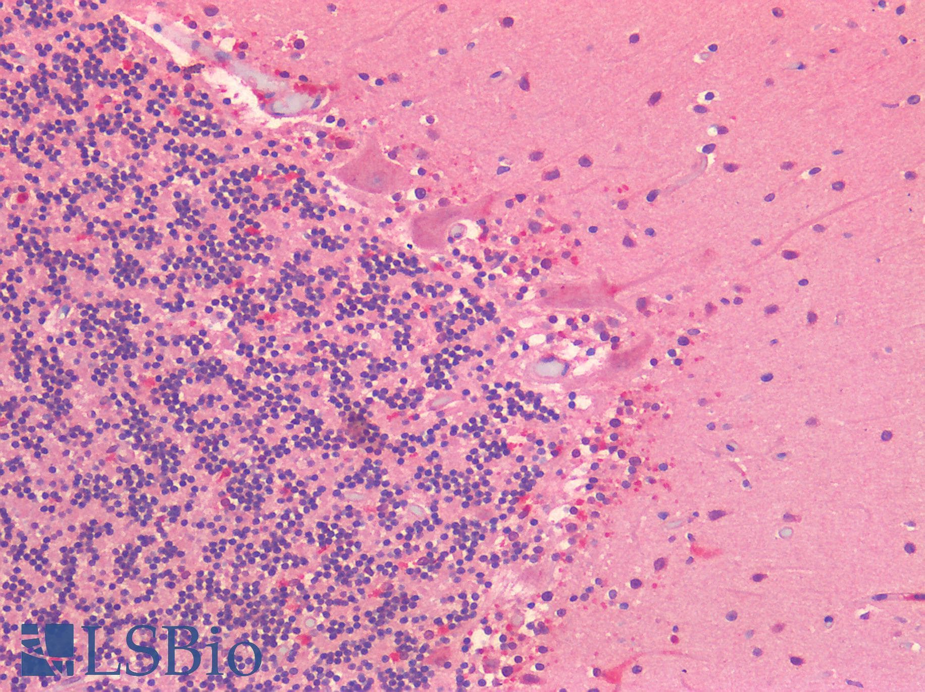 IHC-plus™ NOTCH2 Antibody