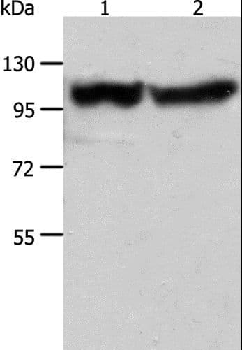 Polyclonal Rabbit anti-Human ACTN3 Antibody (WB)