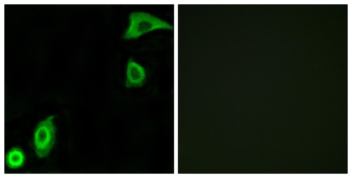 RPS20 / Ribosomal Protein S20 Antibody
