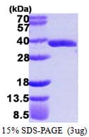 Human HC71 / GLOD4 Protein (Recombinant 6His, N-terminus)