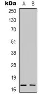 RPS13 / Ribosomal Protein S13 Antibody (Internal)