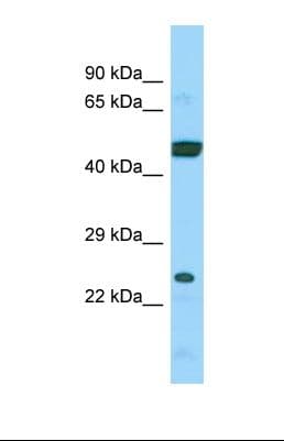ARL6IP4 Antibody (aa216-265)