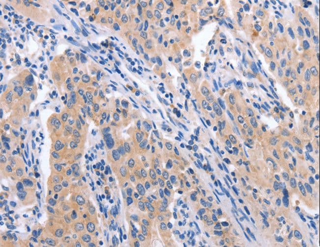 Polyclonal Rabbit anti-Human CCL23 / MIP3 Antibody (IHC)