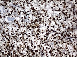 PCNA Antibody (clone OTI6A10)