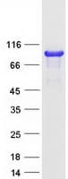 Human CTTN / Cortactin Protein (Recombinant Myc-DDK (Flag))