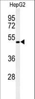 Polyclonal Rabbit anti-Human OPN1MW / GCP Antibody (aa21-50, WB)
