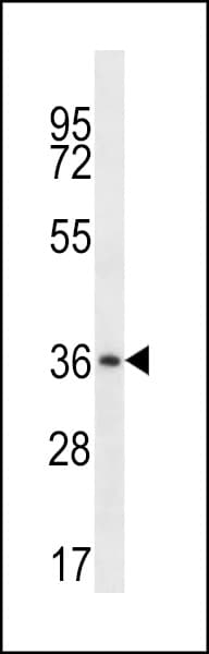 MUL1 / MULAN Antibody (aa272-301)