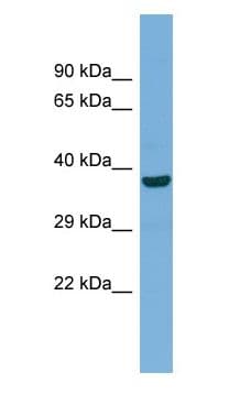 Polyclonal Rabbit anti-Human MFN1 Antibody (aa90-139, WB)