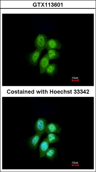 PathPlus™ MVP / VAULT1 Antibody (aa158-380)