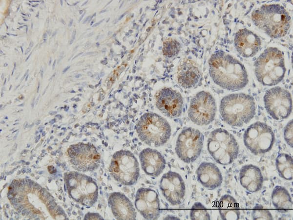 Monoclonal Mouse anti-Human IL37 Antibody (clone 6A6, IHC, WB)