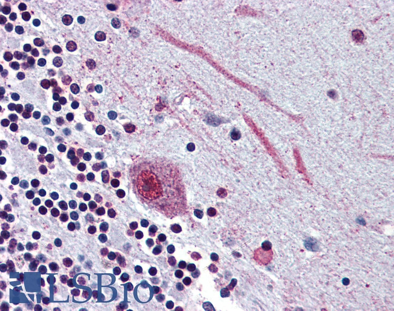IHC-plus™ SLC5A9 / SGLT4 Antibody (Internal)