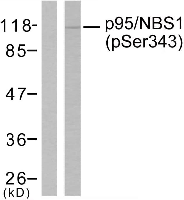 NBN / Nibrin Antibody (phospho-Ser343)