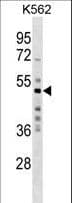 MKRN2 Antibody (aa78-106)