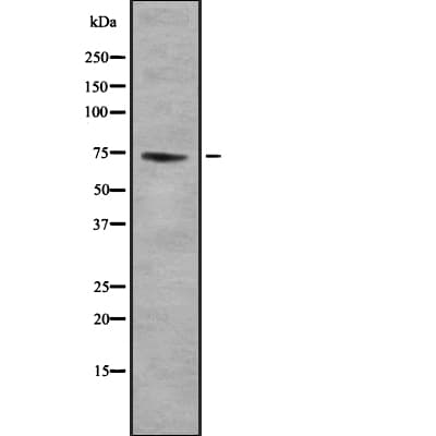 GTPBP4 Antibody