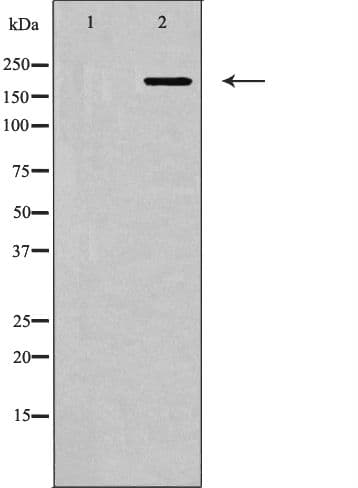 Polyclonal Rabbit anti-Human MYLK Antibody (WB)