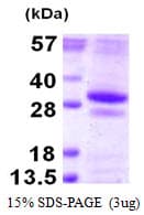 Human GSTO2 Protein (Recombinant His)