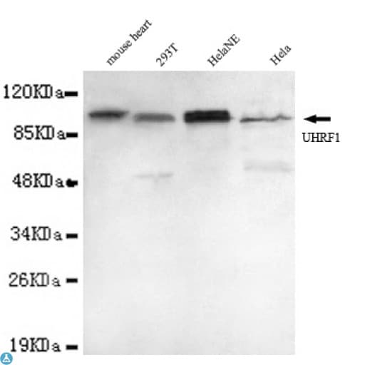 UHRF1 Antibody