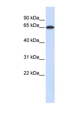 FZD4 / Frizzled 4 Antibody (C-Terminus)