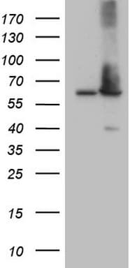 Monoclonal Mouse anti-Human AAAS / Adracalin Antibody (clone OTI5B10, aa322-546, IHC, WB)