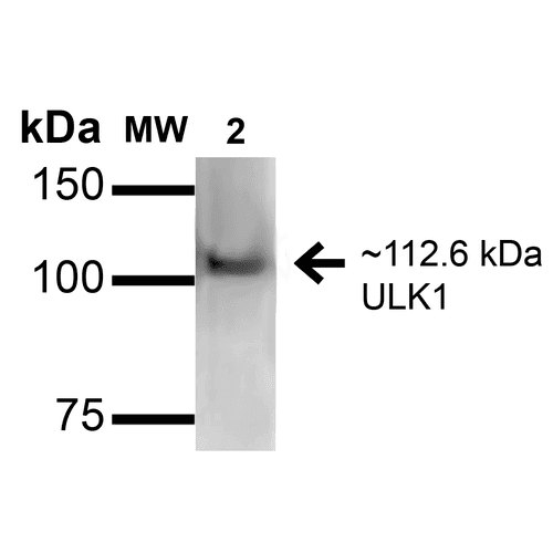 ULK1 Antibody (FITC)