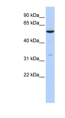 Polyclonal Rabbit anti-Human ZNF266 Antibody (N-Terminus, WB)