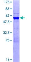 Human RNF4 Protein (Recombinant GST)