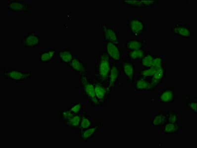 Polyclonal Rabbit anti-Human PRMT6 Antibody (IHC, WB)