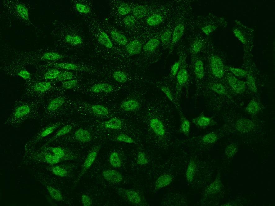 IER5 Antibody
