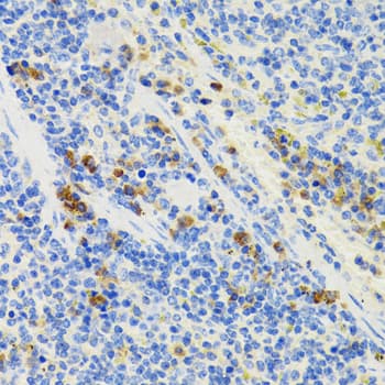 GALT Antibody