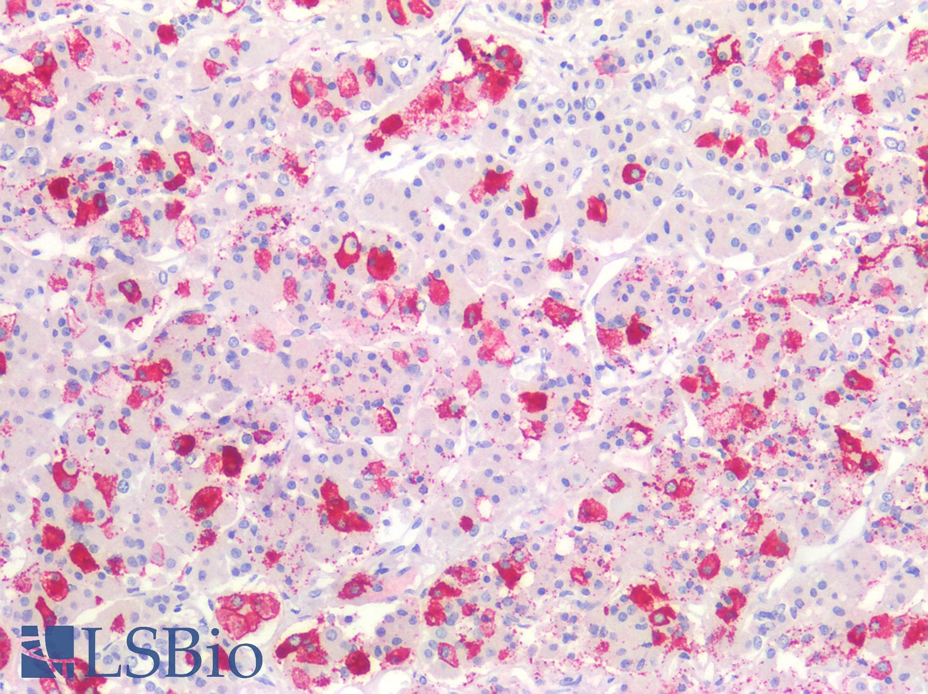 PathPlus™ Thyrotropin / TSH Antibody