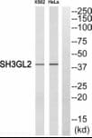 Polyclonal Rabbit anti-Human SH3GL2 Antibody (WB)