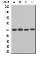 IKZF2 / HELIOS Antibody