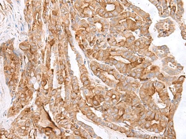 MCAM / CD146 Antibody