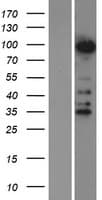 ZNF598 Protein (Over-Expression Lysate Myc-DDK (Flag))