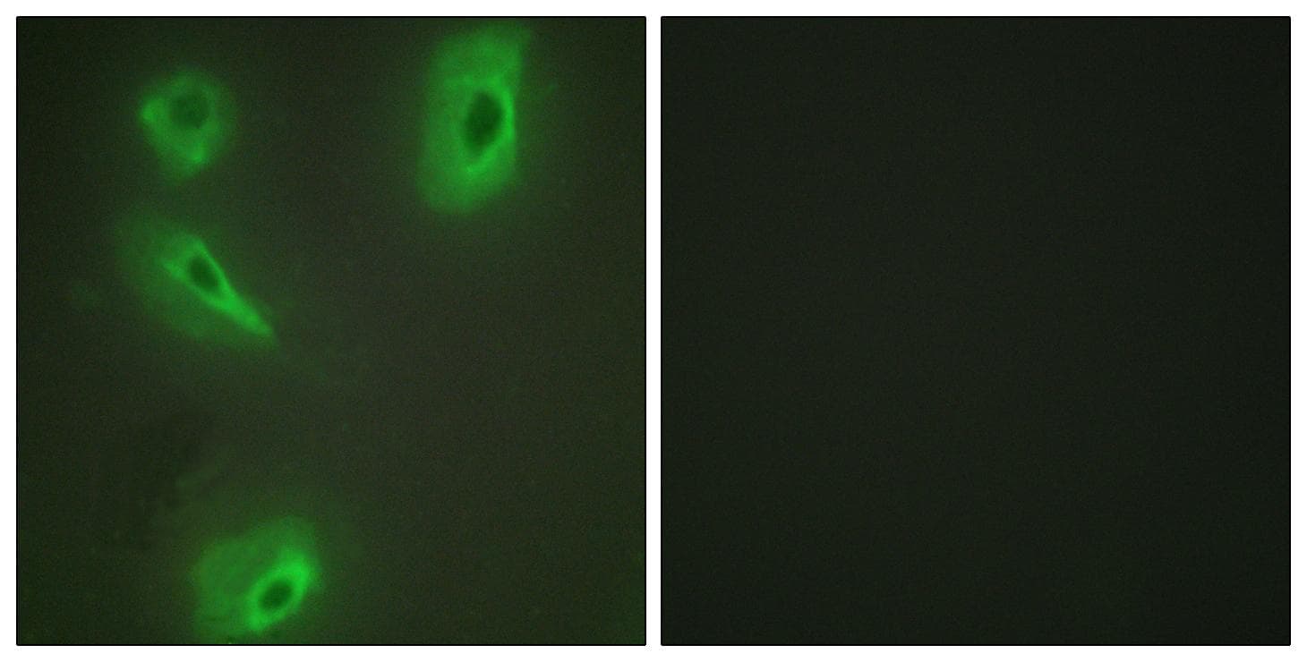 BCKDK Antibody