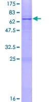 Human AGPAT5 Protein (Recombinant GST)
