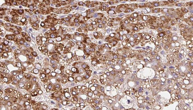 SLC8A1 / NCX1 Antibody