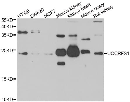 UQCRFS1 Antibody