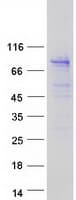 Human HPS / HPS1 Protein (Recombinant Myc-DDK (Flag))