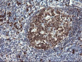 UBE2J1 Antibody (clone OTI1C7)