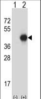 Polyclonal Rabbit anti-Human GNAI2 Antibody (aa78-107, WB)