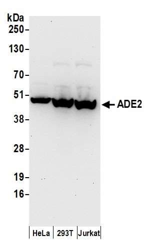 PAICS / ADE2 Antibody (aa1-50)