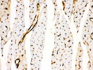 ANXA3 / Annexin A3 Antibody