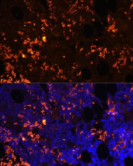 GPR55 Antibody