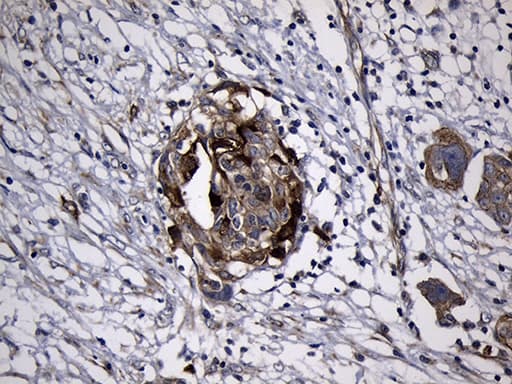 RRM2 Antibody (clone OTI3D3)