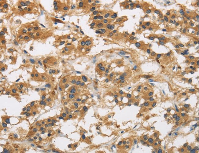 GAS7 Antibody