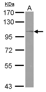 OSBPL5 Antibody (Internal)