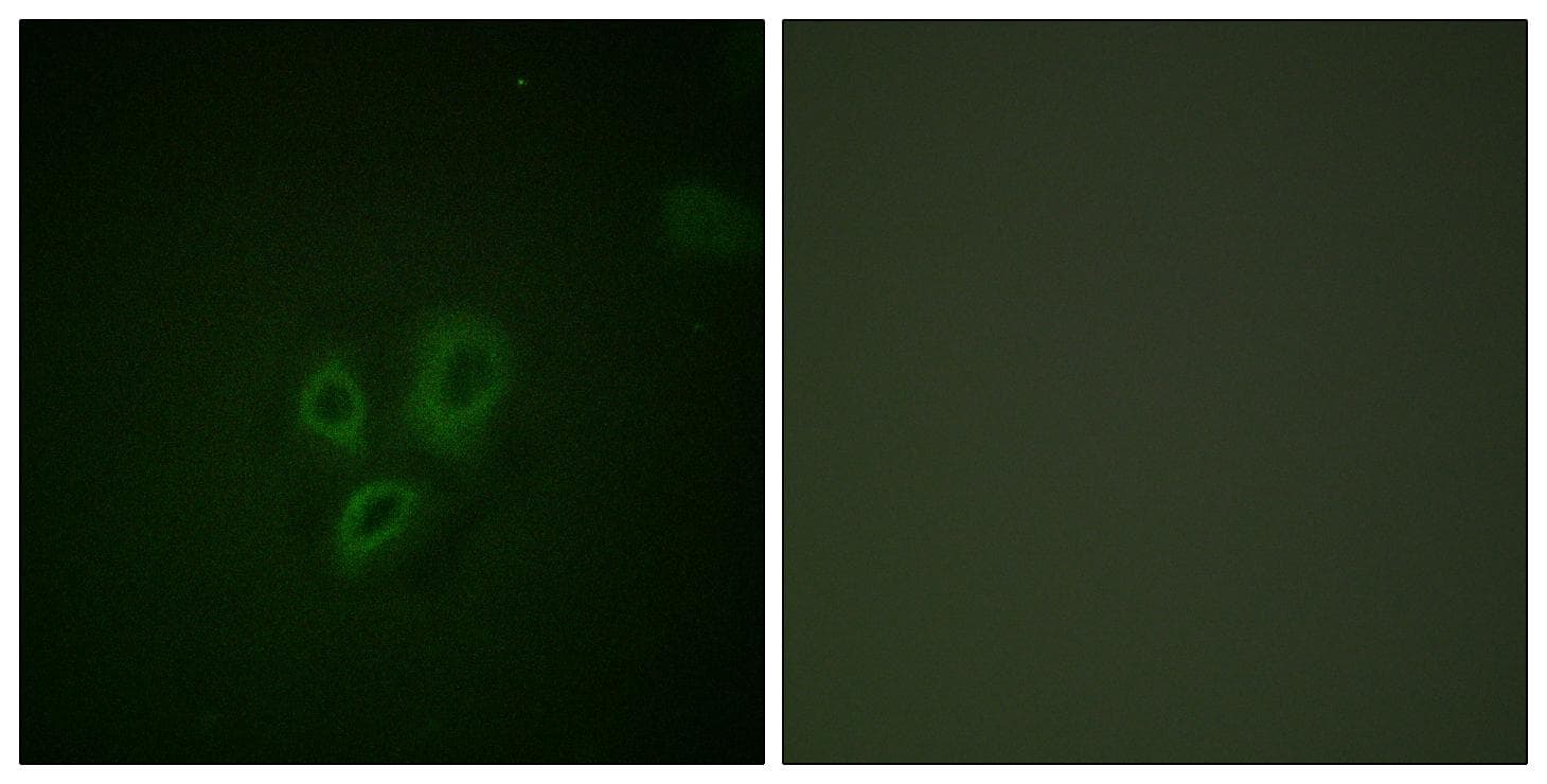 TNNI3 / Cardiac Troponin I Antibody (p22/23)